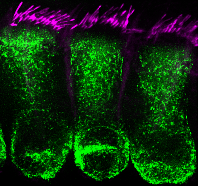 Chris Cunningham hair cell image